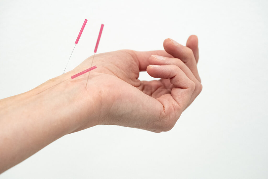 tcm düsseldorf und essen